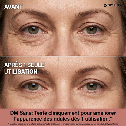 BIOPHOX EYE — Tenseur Regard Instantané